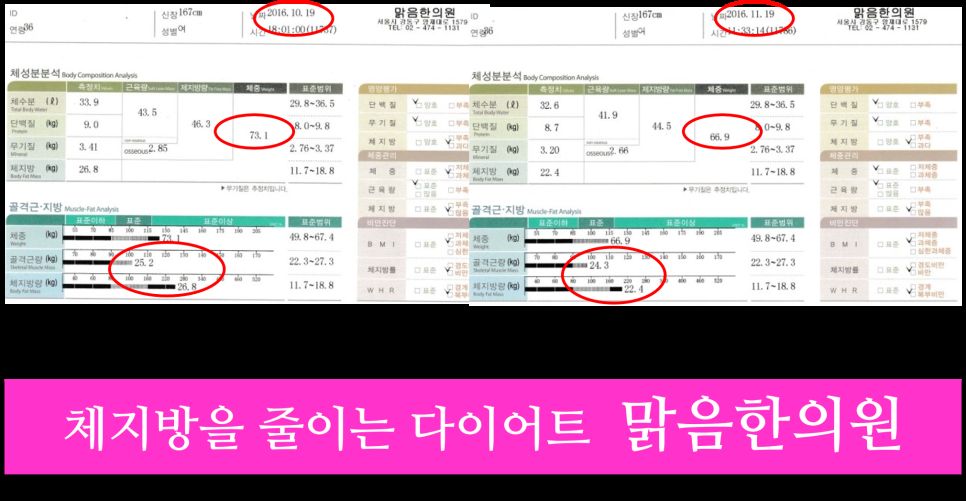 체지방 다이어트 안내